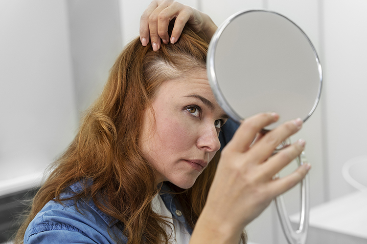  Alopecia: veja os tratamentos naturais e sem efeitos colaterais para o problema 