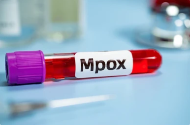 Saiba quais os 8 países que registram casos da nova variante de mpox