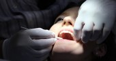 Infecções dentárias e doenças cardíacas podem estar interligadas