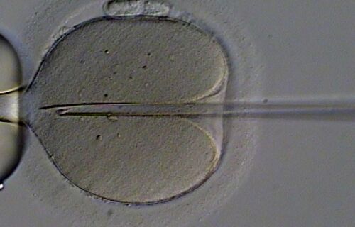 Mulheres que não possuem mais óvulos podem engravidar por fertilização in vitro