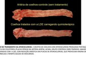 Nanopartículas são usadas contra o câncer