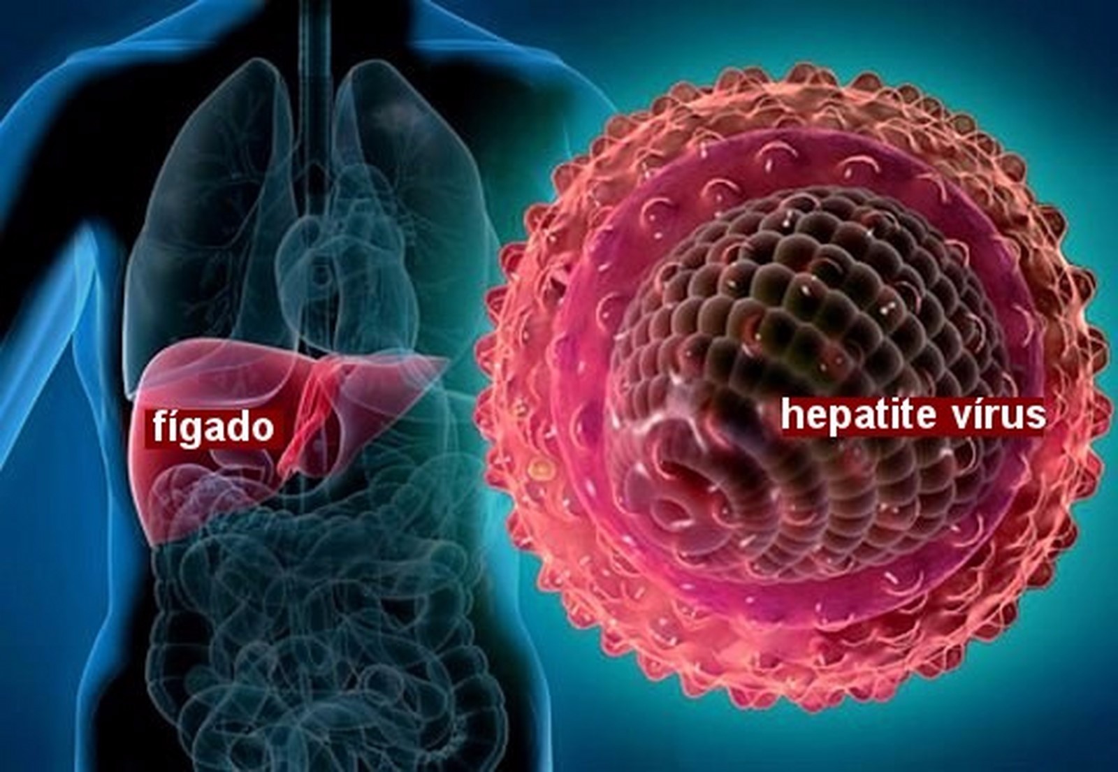 Pesquisa: câncer de fígado é causado pelas hepatites virais B e C