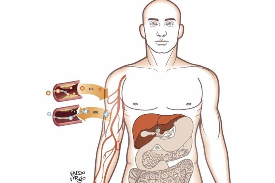 Tratamento: veja como identificar e prevenir o colesterol alto